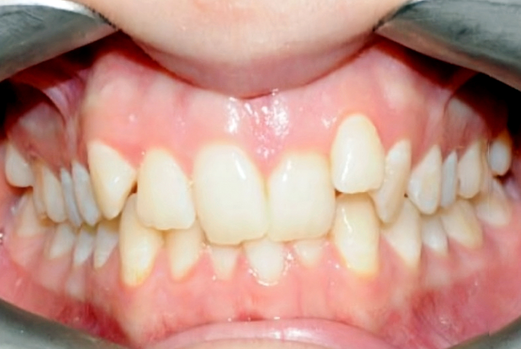 09_before