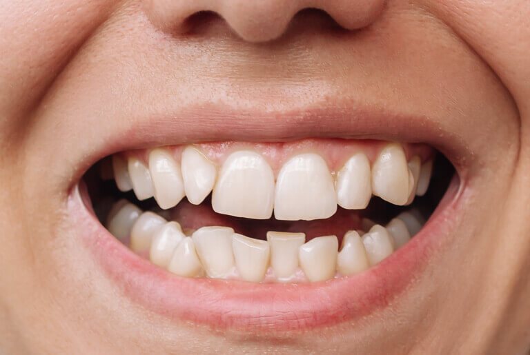 hm_before-after_2-1