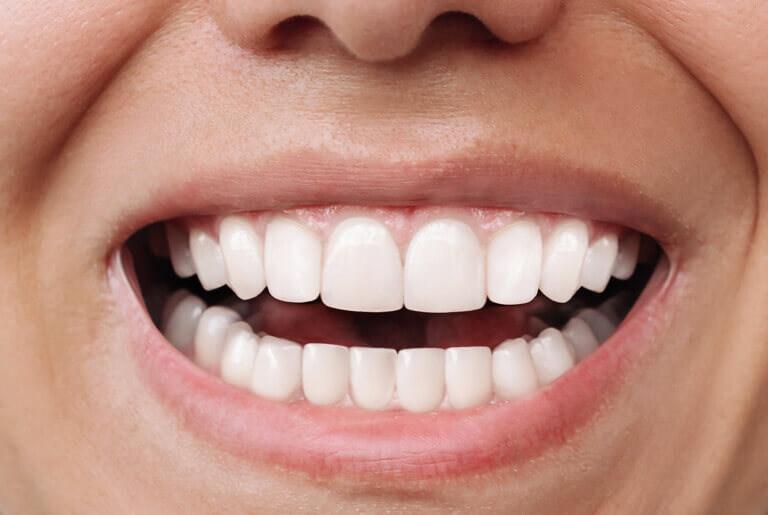 hm_before-after_2-2