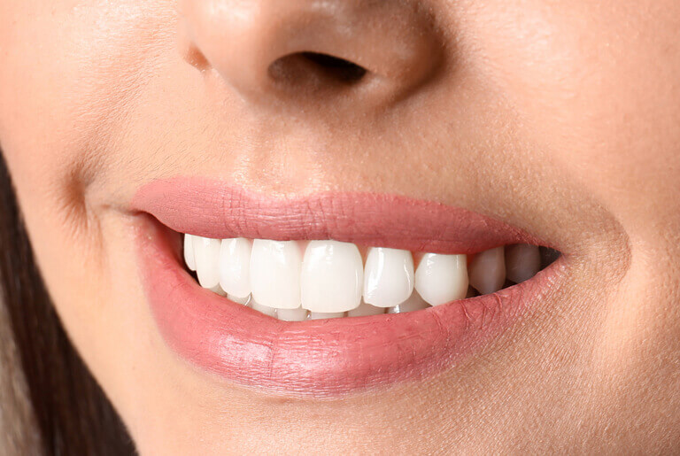hm_before-after_3-2