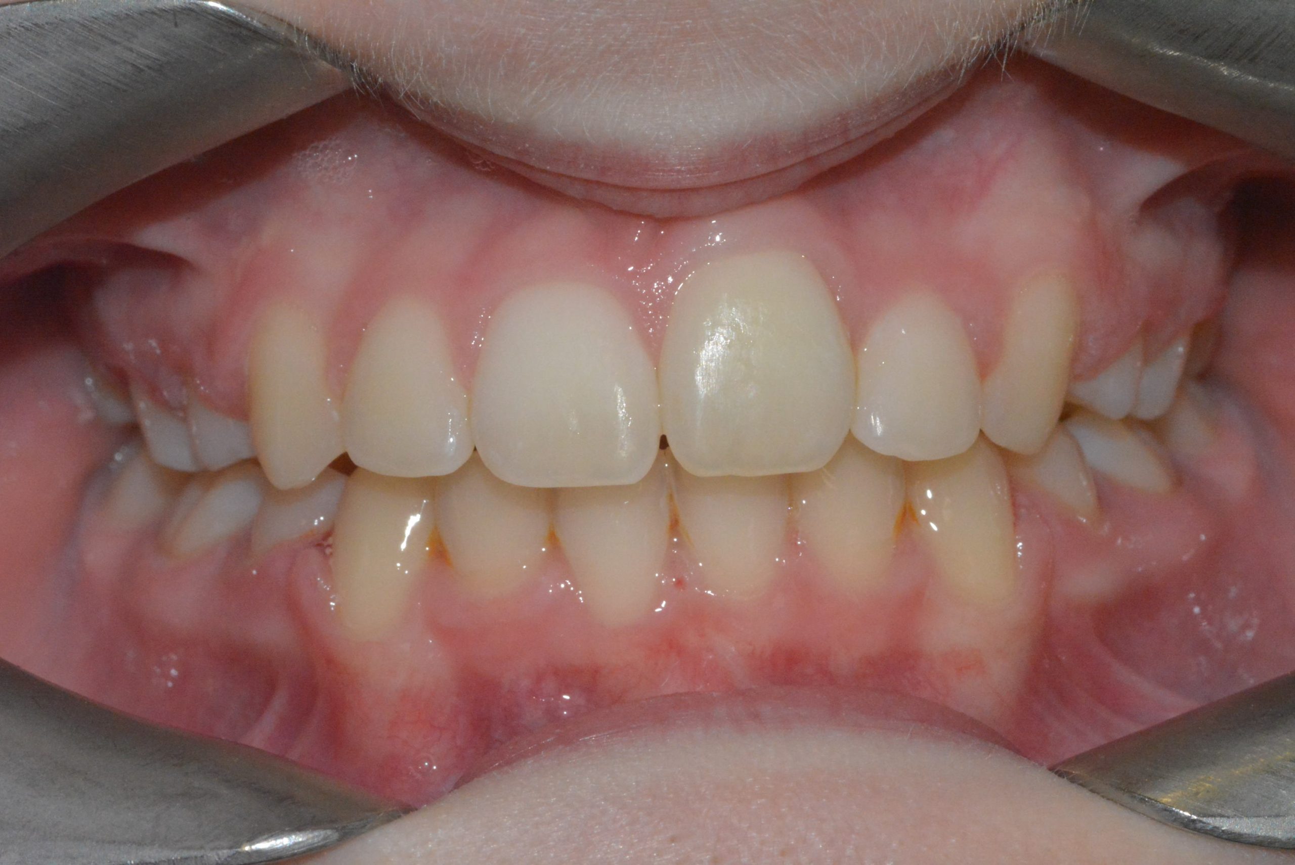 07082 after - fixed (consented)
