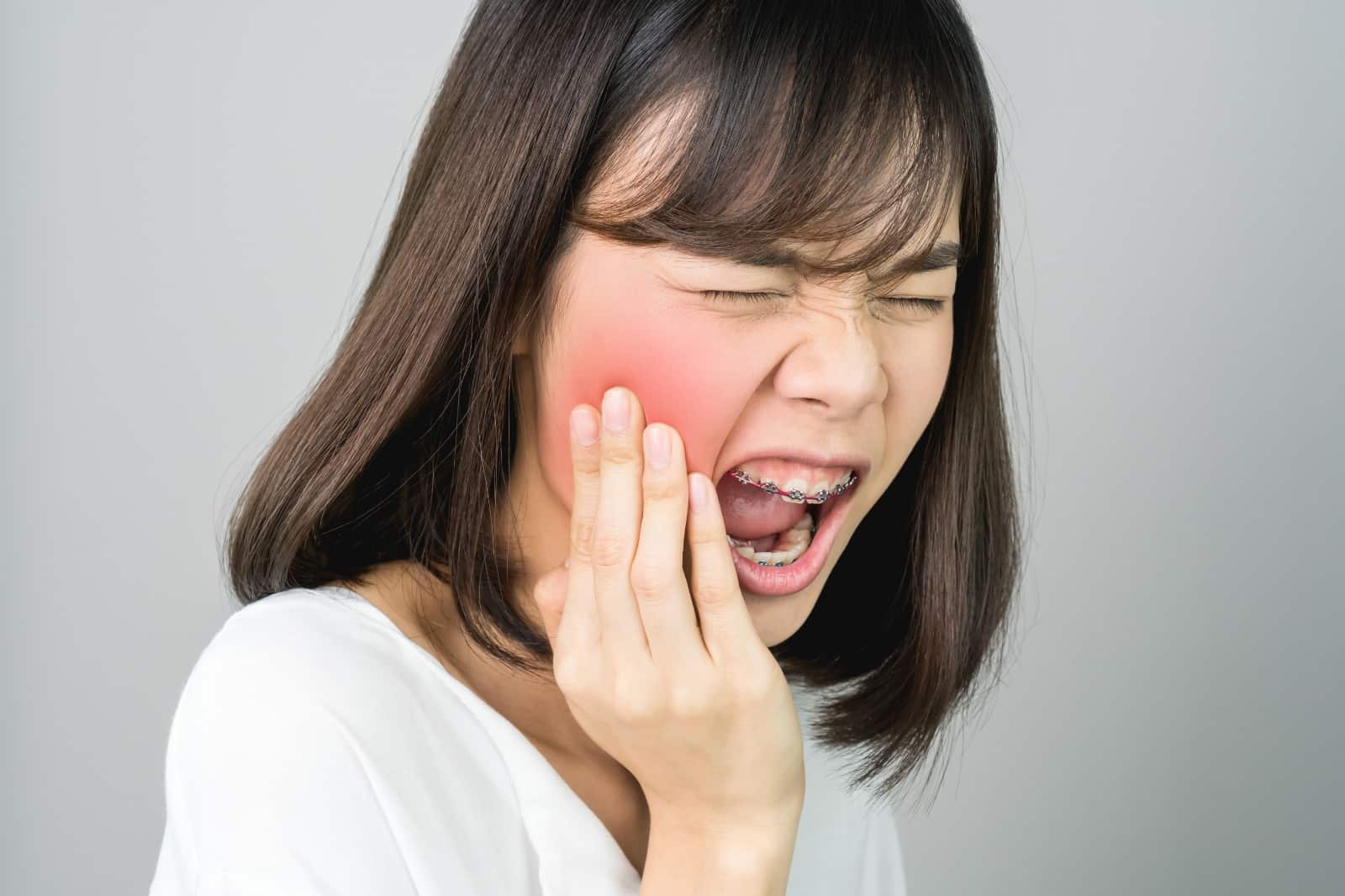 Tips to heal mouth ulcers from braces at Smile Orthodontics