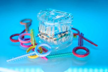 common myths about fixed braces that patients still believe