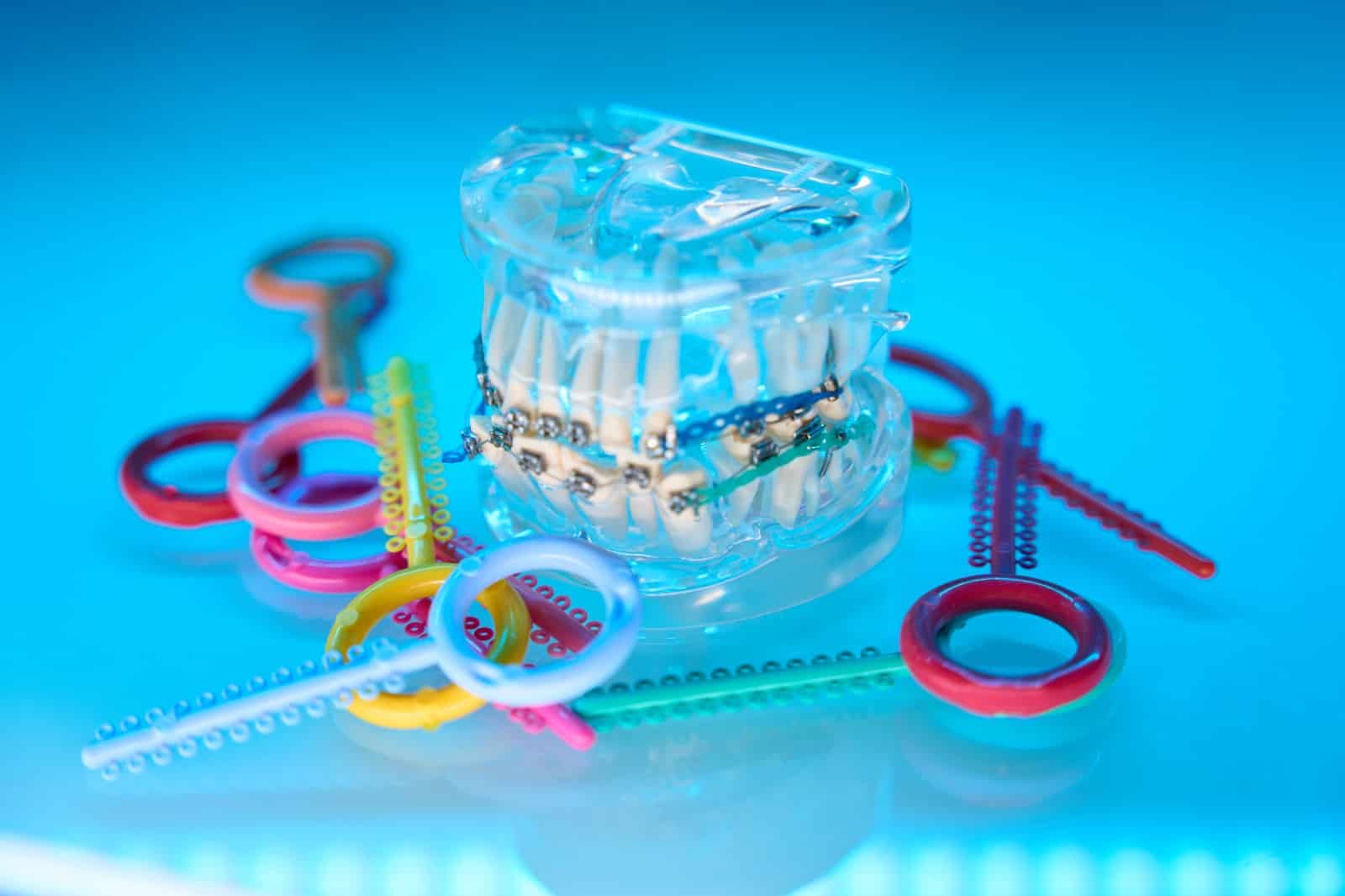 common myths about fixed braces that patients still believe
