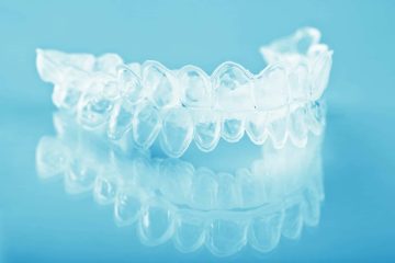 dental retainers explained: why they matter after orthodontic treatment