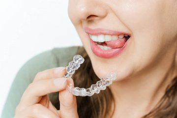 Invisalign smile transformation results