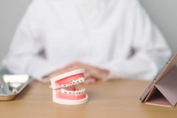 Patient choosing between NHS and private braces treatment