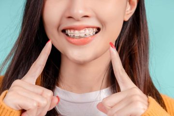 woman-smiling-with-braces-points-to-her-teeth-woman-facing-alignment-issue